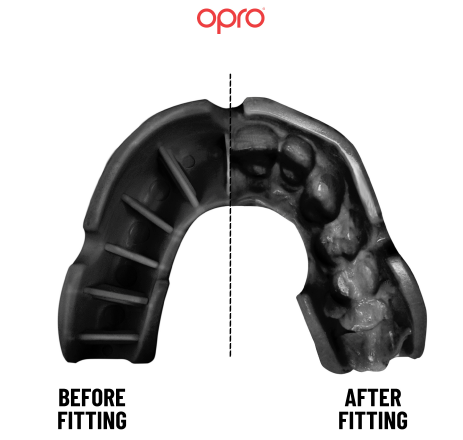 OPRO Bronze YOUTH Self-Fit Mouthguard