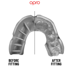 OPRO Silver ADULT Self-Fit Mouthguard